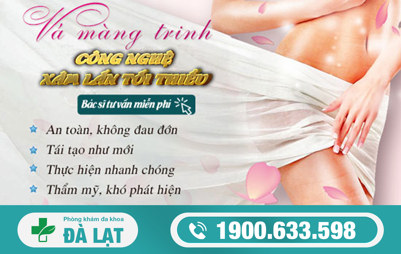 Hình ảnh minh họa